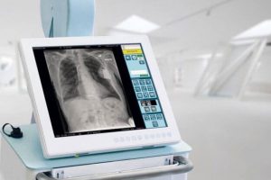 В Добрянской больнице появился новый рентген-аппарат